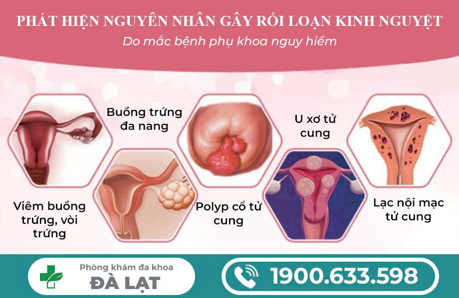 Hình ảnh minh họa